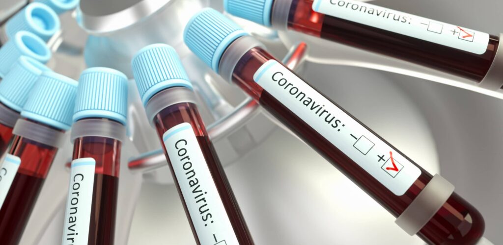 Coronavirus - © ktsimage