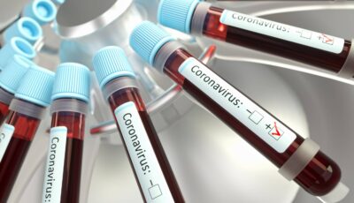 Coronavirus - © ktsimage