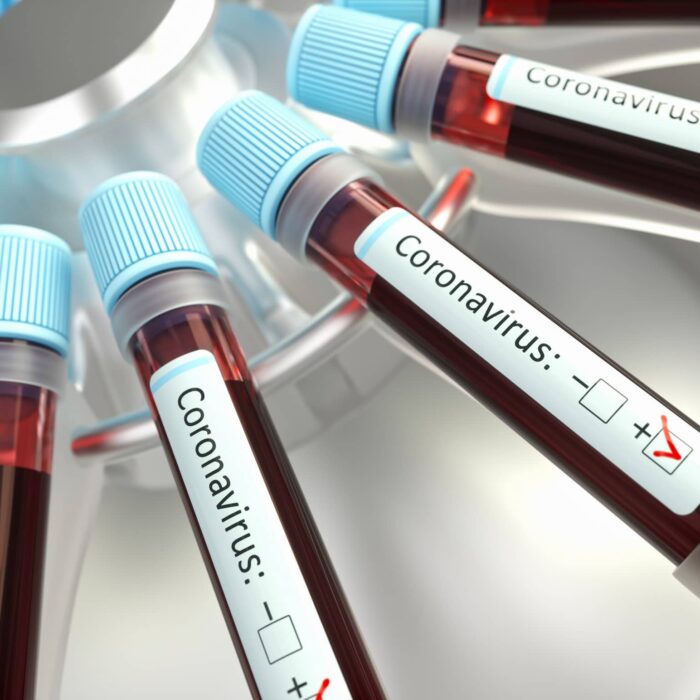 Coronavirus - © ktsimage