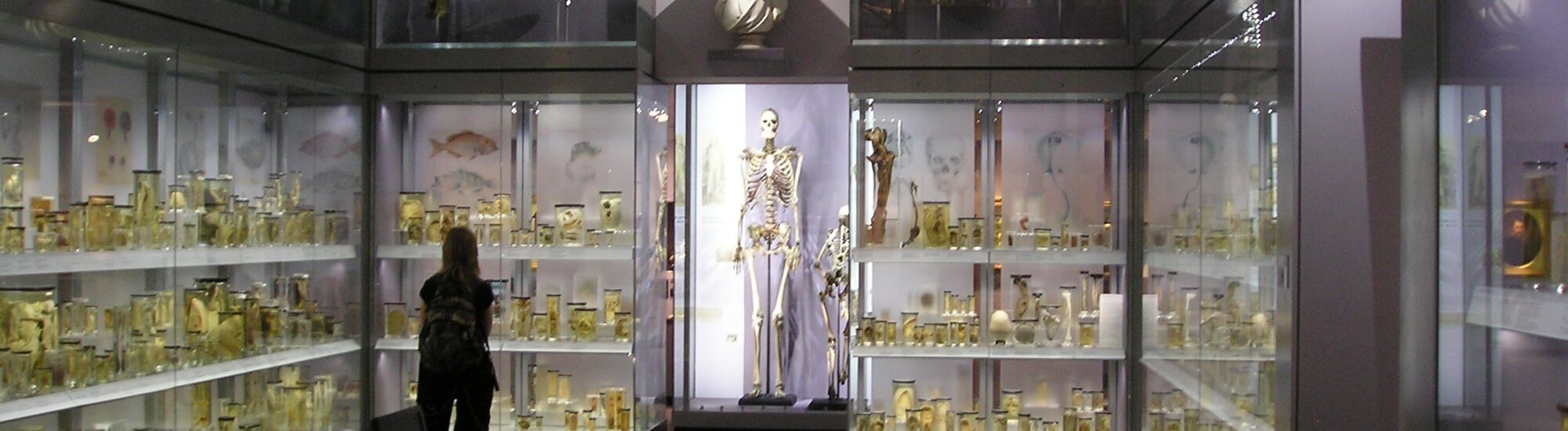 Charles Byrne, le géant irlandais